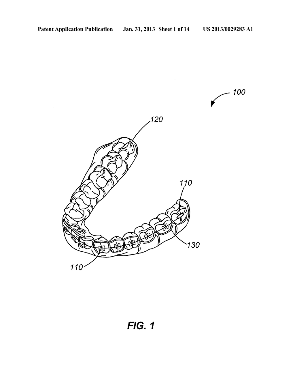 SYSTEMS AND METHODS FOR TRACKING TEETH MOVEMENT DURING ORTHODONTIC     TREATMENT - diagram, schematic, and image 02