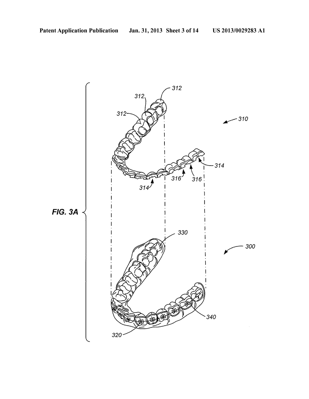 SYSTEMS AND METHODS FOR TRACKING TEETH MOVEMENT DURING ORTHODONTIC     TREATMENT - diagram, schematic, and image 04