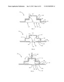 ORTHODONTIC ATTACHMENT DEVICE SYSTEMS AND METHODS diagram and image