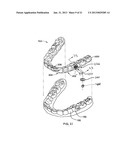 ORTHODONTIC ATTACHMENT DEVICE SYSTEMS AND METHODS diagram and image