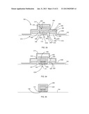 ORTHODONTIC ATTACHMENT DEVICE SYSTEMS AND METHODS diagram and image