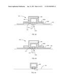 ORTHODONTIC ATTACHMENT DEVICE SYSTEMS AND METHODS diagram and image