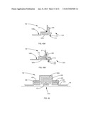 ORTHODONTIC ATTACHMENT DEVICE SYSTEMS AND METHODS diagram and image