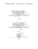 ORTHODONTIC ATTACHMENT DEVICE SYSTEMS AND METHODS diagram and image