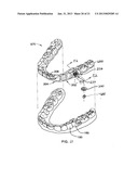 ORTHODONTIC ATTACHMENT DEVICE SYSTEMS AND METHODS diagram and image