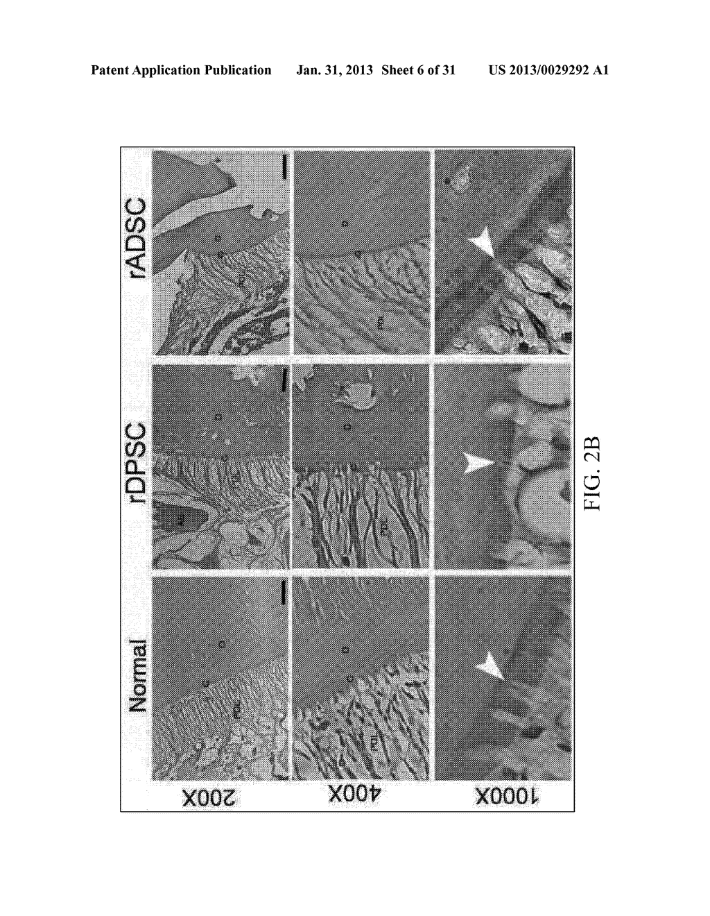 METHOD OF IMPLANTING MESENCHYMAL STEM CELLS FOR NATURAL TOOTH REGENERATION     IN SURGICALLY PREPARED EXTRACTION SOCKET AND COMPOSITIONS THEREOF - diagram, schematic, and image 07