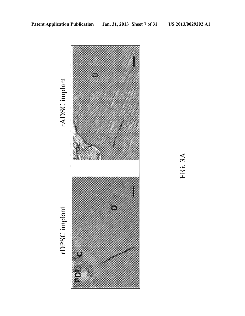 METHOD OF IMPLANTING MESENCHYMAL STEM CELLS FOR NATURAL TOOTH REGENERATION     IN SURGICALLY PREPARED EXTRACTION SOCKET AND COMPOSITIONS THEREOF - diagram, schematic, and image 08