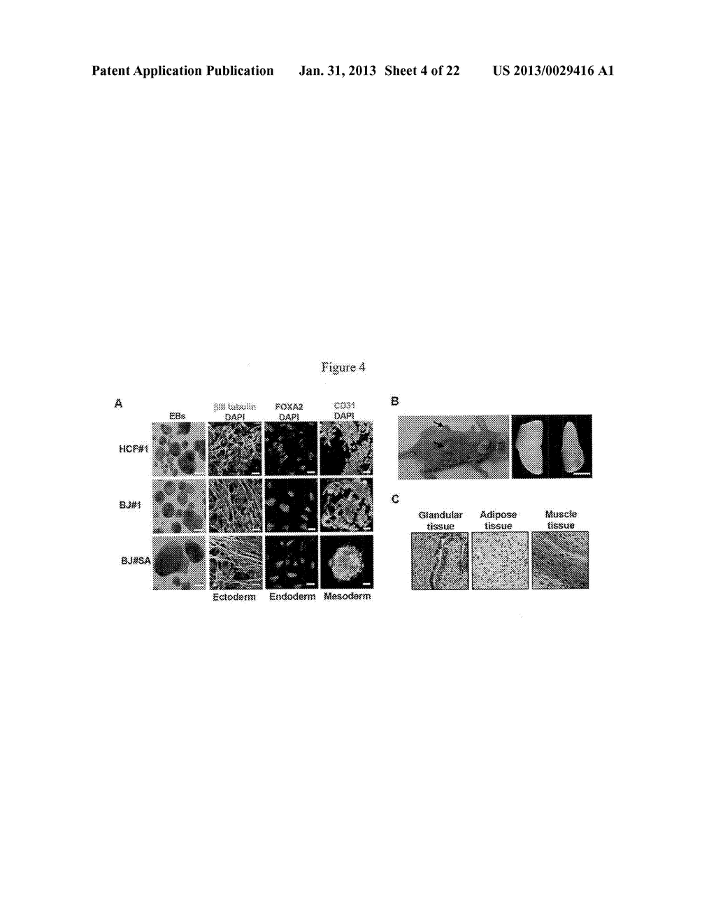 DIFFERENTIATING INDUCED PLURIPOTENT STEM CELLS INTO GLUCOSE-RESPONSIVE,     INSULIN-SECRETING PROGENY - diagram, schematic, and image 05