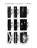 Genetic Inhibition by Double-Stranded RNA diagram and image