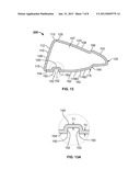 Golf Club Head or Other Ball Striking Device Having Impact-Influencing     Body Features diagram and image