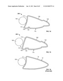 Golf Club Head or Other Ball Striking Device Having Impact-Influencing     Body Features diagram and image