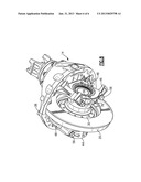 ADJUSTING RING LOCK diagram and image