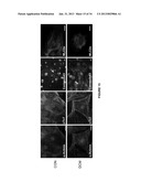 CARDIOMYOCYTES FROM INDUCED PLURIPOTENT STEM CELLS FROM PATIENTS AND     METHODS OF USE THEREOF diagram and image