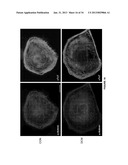 CARDIOMYOCYTES FROM INDUCED PLURIPOTENT STEM CELLS FROM PATIENTS AND     METHODS OF USE THEREOF diagram and image