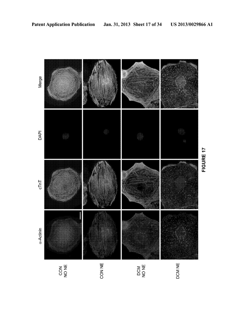 CARDIOMYOCYTES FROM INDUCED PLURIPOTENT STEM CELLS FROM PATIENTS AND     METHODS OF USE THEREOF - diagram, schematic, and image 18