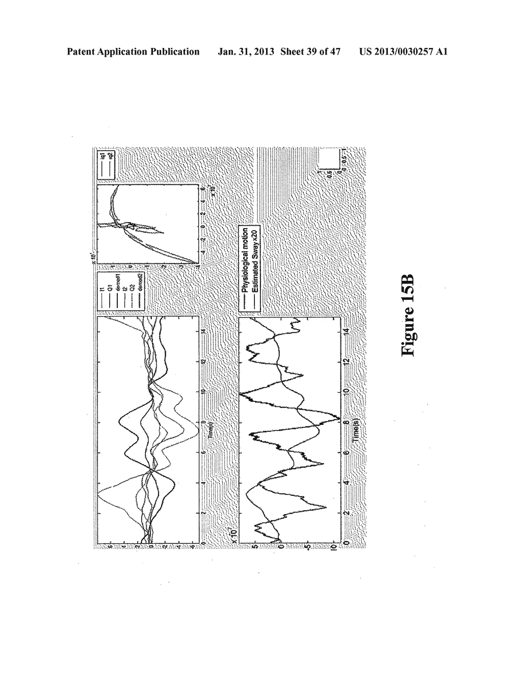 SYSTEMS AND METHODS FOR NON-CONTACT MULTIPARAMETER VITAL SIGNS MONITORING,     APNEA THERAPY, APNEA DIAGNOSIS, AND SNORE THERAPY - diagram, schematic, and image 40