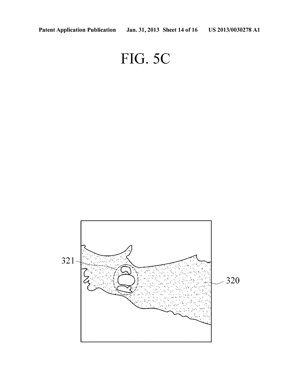 APPARATUS AND METHOD FOR DETECTING LESION AND LESION DIAGNOSIS APPARATUS - diagram, schematic, and image 15