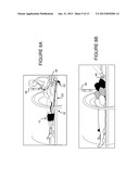 TOURNIQUET FOR MAGNETIC RESONANCE ANGIOGRAPHY, AND METHOD OF USING SAME diagram and image