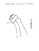 TOURNIQUET FOR MAGNETIC RESONANCE ANGIOGRAPHY, AND METHOD OF USING SAME diagram and image