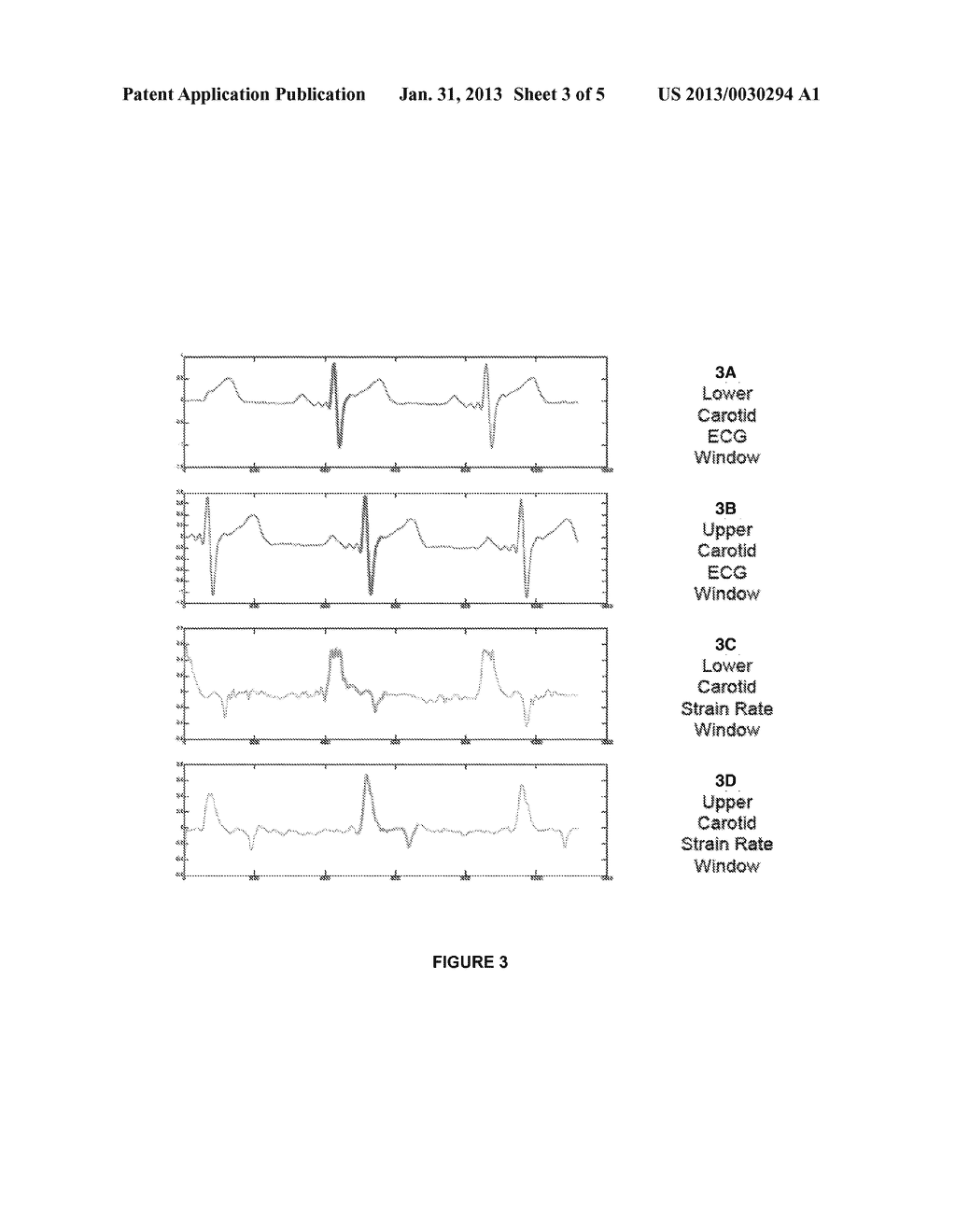 Method and System for Ultrasound Image Computation of Cardiac Events - diagram, schematic, and image 04