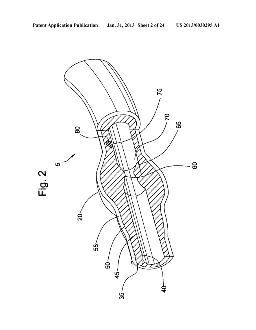 Three Dimensional Co-Registration for Intravascular Diagnosis and Therapy - diagram, schematic, and image 03