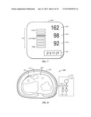 BLOOD PRESSURE MEASUREMENT DEVICE diagram and image