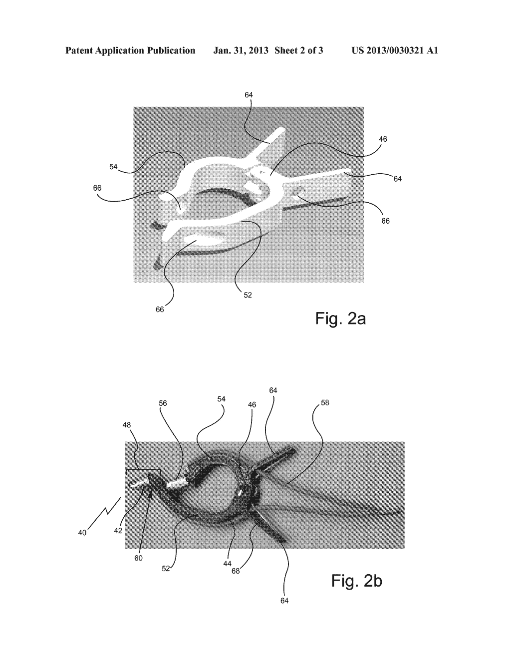 CONCHA ELECTRODE - diagram, schematic, and image 03