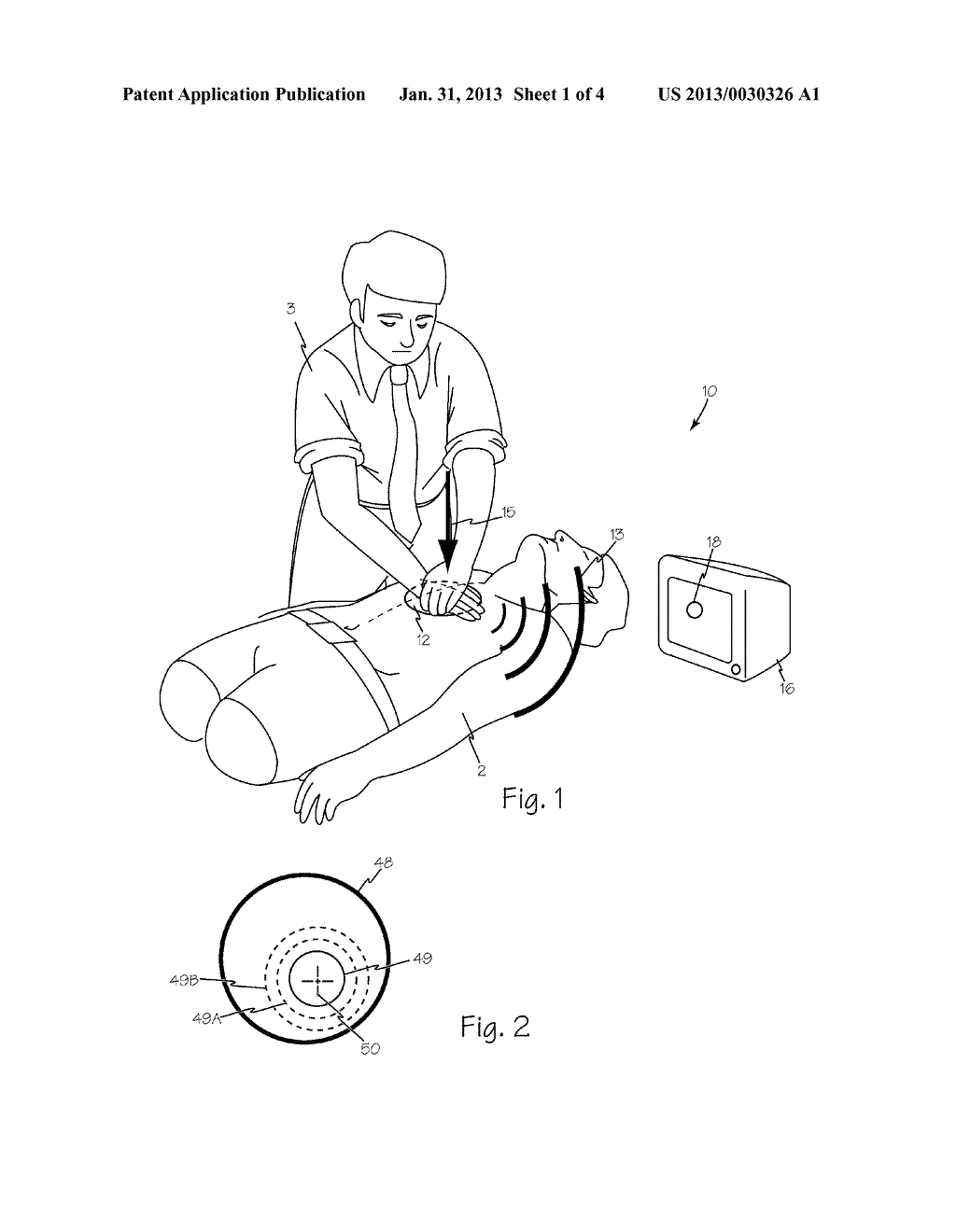 Method and Apparatus for Monitoring Manual Chest Compression Efficiency     During CPR - diagram, schematic, and image 02