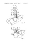 Method and Apparatus for Monitoring Manual Chest Compression Efficiency     During CPR diagram and image