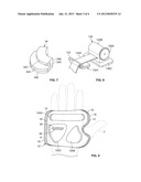 THERAPEUTIC COMPRESSION DEVICE AND METHOD diagram and image