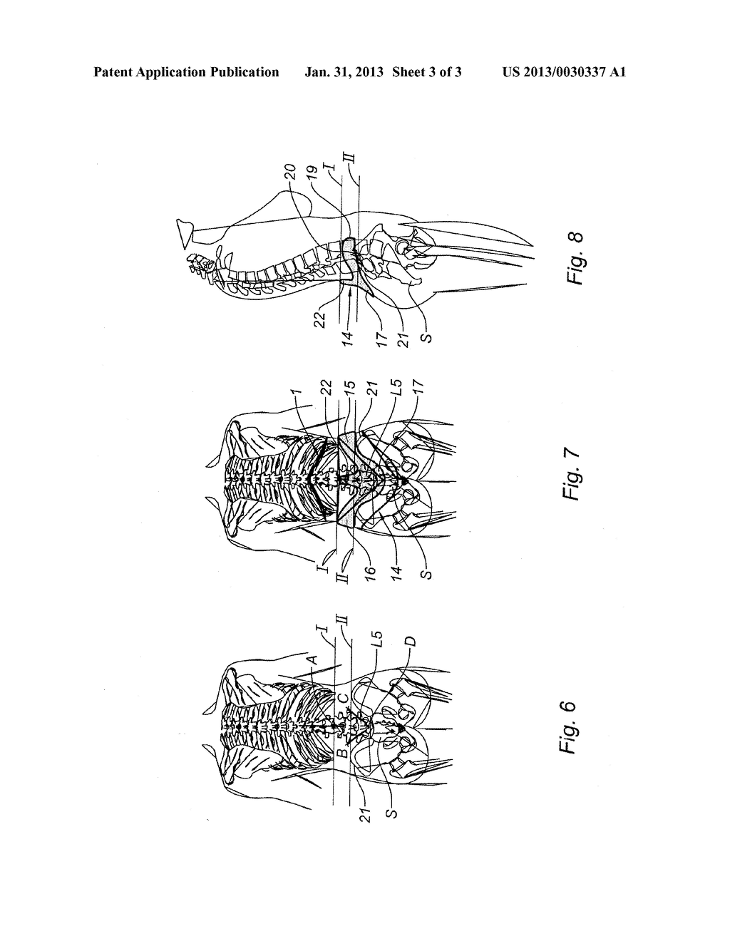 LUMBAR SUPPORT BELT - diagram, schematic, and image 04