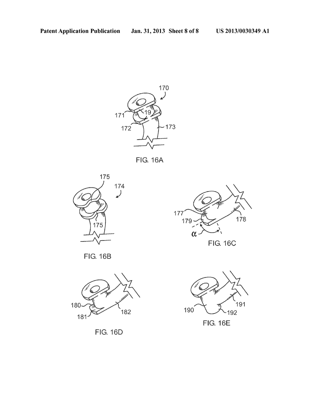 Side-by-side lacrimal intubation threader device - diagram, schematic, and image 09