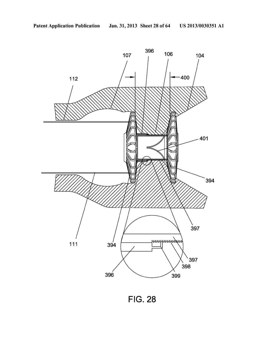 DELIVERY DEVICES AND METHODS FOR GASTROINTESTINAL IMPLANTS - diagram, schematic, and image 29