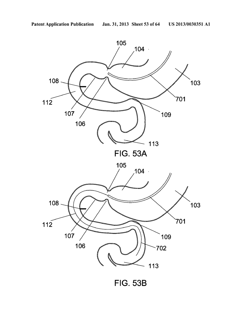 DELIVERY DEVICES AND METHODS FOR GASTROINTESTINAL IMPLANTS - diagram, schematic, and image 54