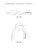 SYSTEMS AND METHODS UTILIZING SHAPE SENSING FIBERS diagram and image