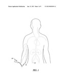 VASCULAR INTRODUCER INCLUDING EXPANDABLE PASSAGE MEMBER diagram and image