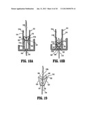 Vascular Access Assembly and Safety Device diagram and image