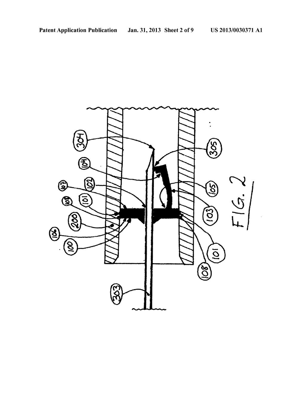 POLYMERIC CATHETER NEEDLE TIP SHIELDING DEVICE - diagram, schematic, and image 03