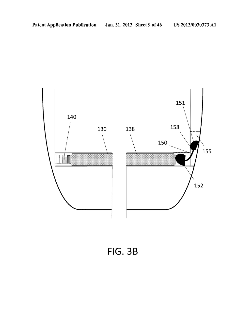 Angiocatheter System With Anti-Leak Features - diagram, schematic, and image 10