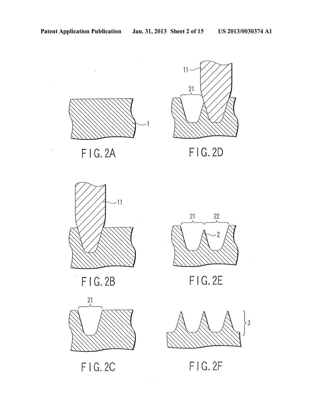 MICRONEEDLE AND METHOD OF MANUFACTURING MICRONEEDLE - diagram, schematic, and image 03