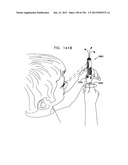 AUTOMATIC INJECTION DEVICE diagram and image