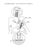 AUTOMATIC INJECTION DEVICE diagram and image