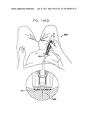 AUTOMATIC INJECTION DEVICE diagram and image