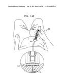 AUTOMATIC INJECTION DEVICE diagram and image