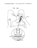 AUTOMATIC INJECTION DEVICE diagram and image