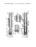 AUTOMATIC INJECTION DEVICE diagram and image