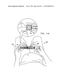 AUTOMATIC INJECTION DEVICE diagram and image