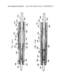 AUTOMATIC INJECTION DEVICE diagram and image