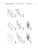 APPLICATOR MEMBER AND FLEXIBLE RETENTION WEB DEVICE diagram and image