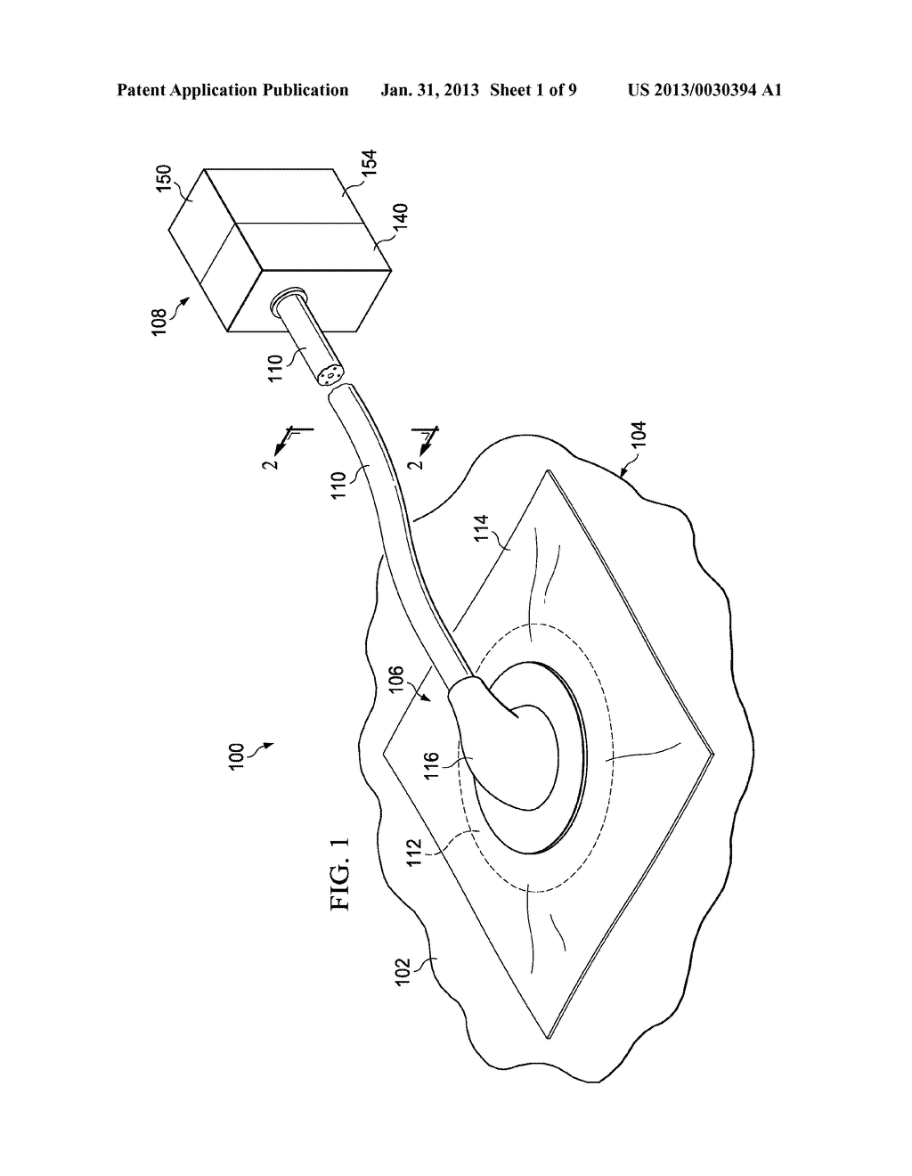 SYSTEMS AND METHODS FOR TREATING A TISSUE SITE WITH REDUCED PRESSURE     INVOLVING A REDUCED-PRESSURE INTERFACE HAVING A CUTTING ELEMENT - diagram, schematic, and image 02